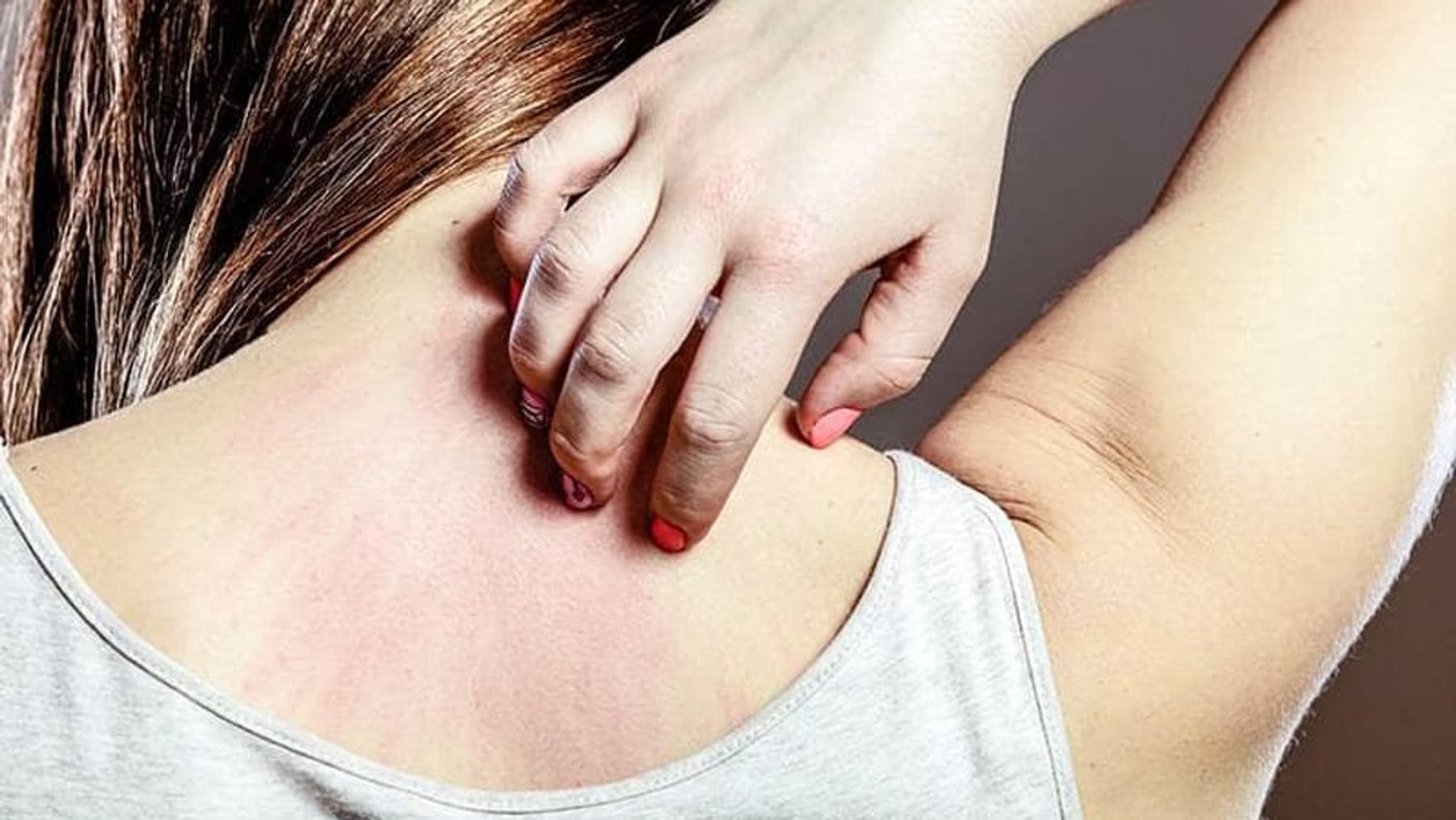 Cách xử lý vải bị ngứa